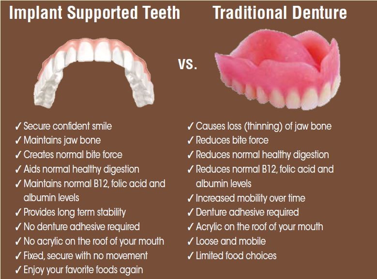 Implant Supported Dentures College Park MD 20740